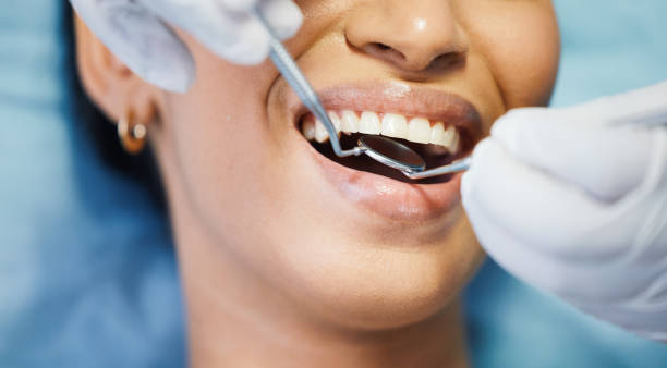 Best Dentist for Tooth Abscess  in La Crescent, MN