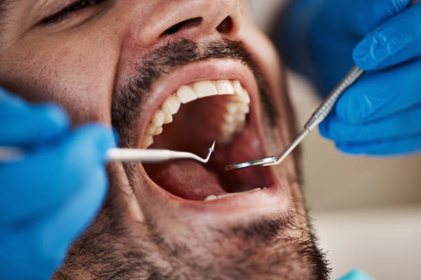 Best Broken Tooth Emergency  in La Crescent, MN